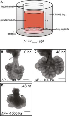 Negative Transpulmonary Pressure Disrupts Airway Morphogenesis by Suppressing Fgf10